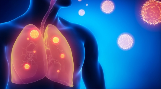 Elk jaar 3000 sterfgevallen door werk